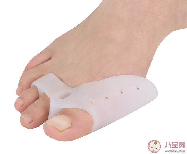如何判斷自己是否有拇外翻 拇趾外翻穿矯正器有用嗎 如何判斷自己是否有拇外翻 拇趾外翻穿矯正器有用嗎