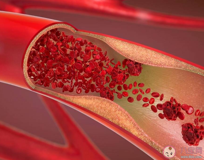 這些血管軟化方法不可信 想要血管健康要做好這些事 這些血管軟化方法不可信 想要血管健康要做好這些事