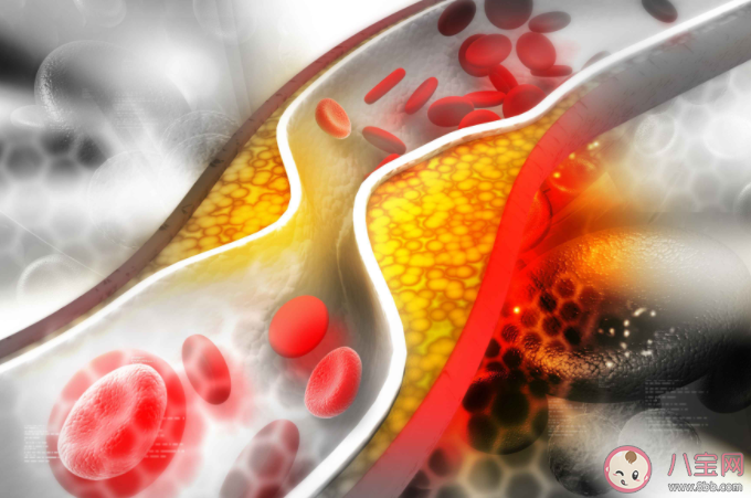 這些血管軟化方法不可信 想要血管健康要做好這些事 這些血管軟化方法不可信 想要血管健康要做好這些事