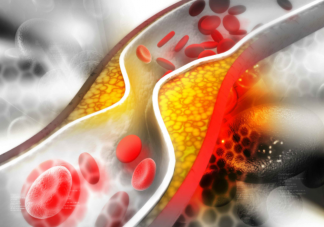 這些血管軟化方法不可信 想要血管健康要做好這些事