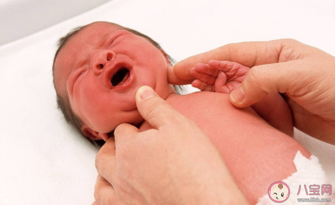 腸絞痛常見原因 寶寶腸絞痛怎么護理 腸絞痛常見原因 寶寶腸絞痛怎么護理