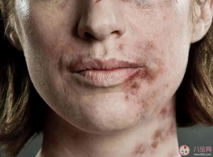 遭遇家暴如何申請(qǐng)人身安全保護(hù)令 人身安全保護(hù)令的時(shí)效是多久