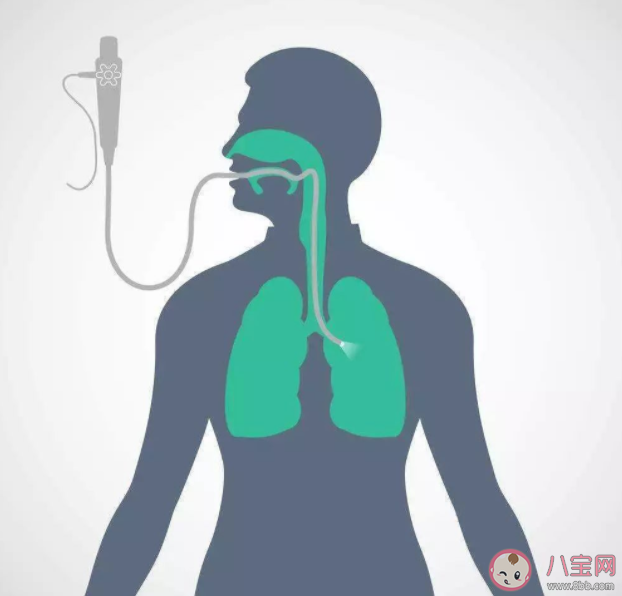 胃鏡檢查前為什么要做心電圖 胃鏡檢查前需要做好什么準備 胃鏡檢查前為什么要做心電圖 胃鏡檢查前需要做好什么準備