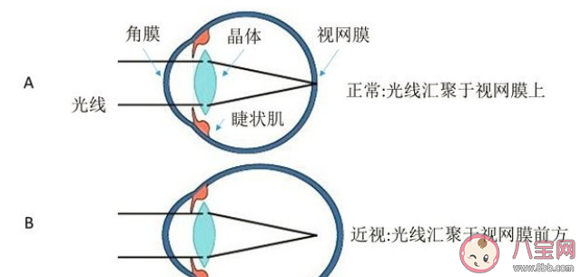 超負荷用眼危害有多大 怎樣保護眼睛
