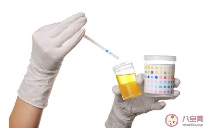 人體缺乏尿酸會怎樣 尿酸的好處有什么