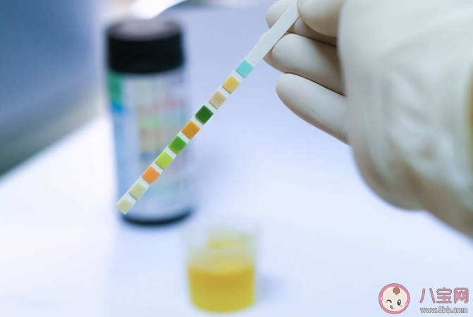 人體缺乏尿酸會怎樣 尿酸的好處有什么