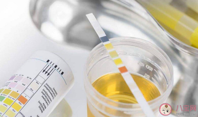 人體缺乏尿酸會怎樣 尿酸的好處有什么