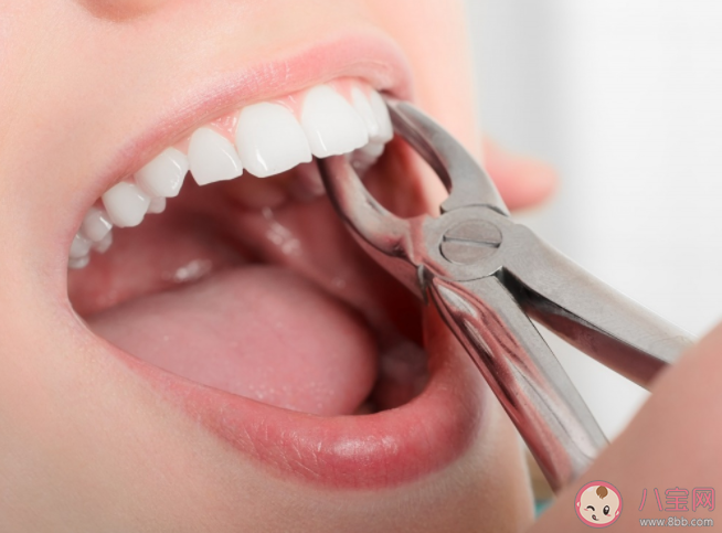 拔牙有哪些禁忌癥 拔牙后的三個關鍵時間點