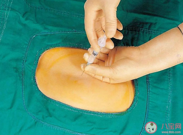 我國僅30%產婦使用無痛分娩 無痛分娩有什么危害嗎