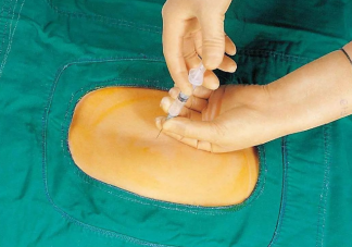 我國僅30%產婦使用無痛分娩 無痛分娩有什么危害嗎