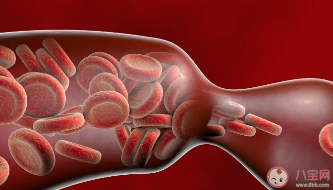 7個跡象發現致命血栓 什么環境下容易長血栓 7個跡象發現致命血栓 什么環境下容易長血栓