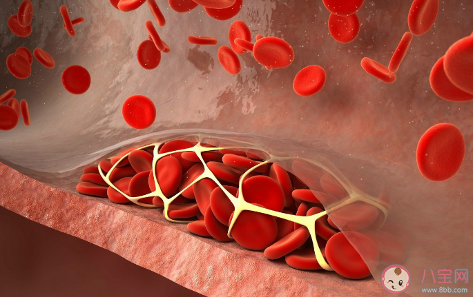 2022世界血栓日主題是什么 預防血栓做好7件小事 2022世界血栓日主題是什么 預防血栓做好7件小事