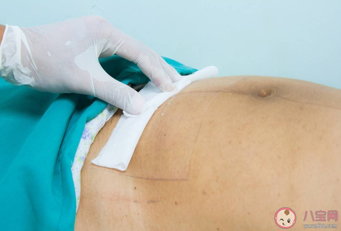 二胎剖腹產需提前多少周為好 二胎剖腹產比一胎疼嗎