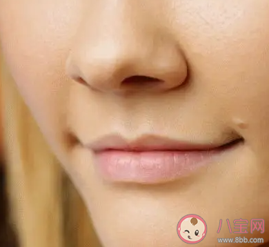 秋冬容易爛嘴角有哪些原因 怎樣預防爛嘴角