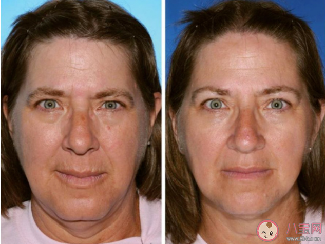 孤獨丑是什么意思 年輕人比老人更孤獨嗎