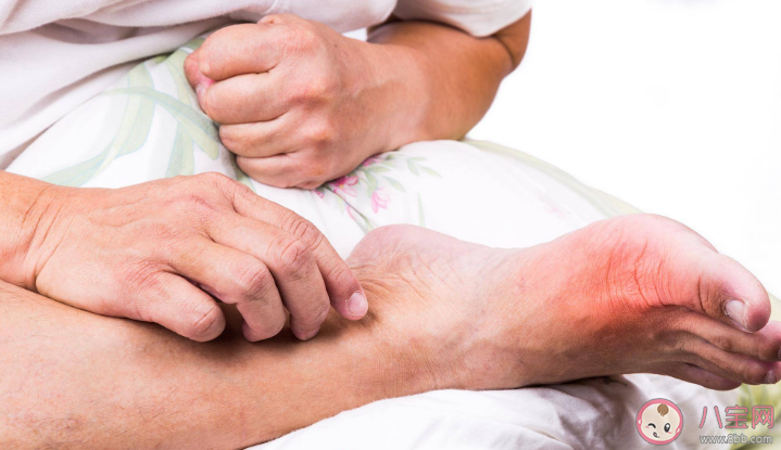 痛風患者不能泡腳嗎 痛風緩解期如何正確泡腳