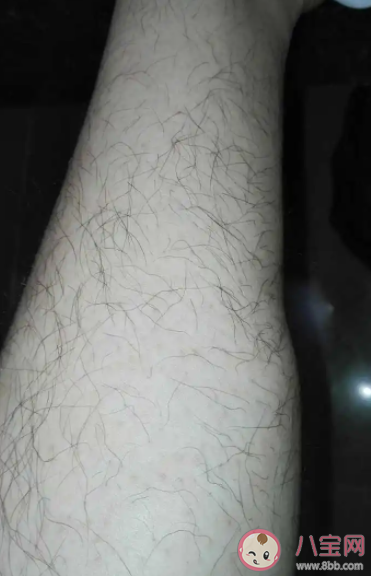女生腿毛會越刮越粗越硬嗎 腿毛多該怎么辦