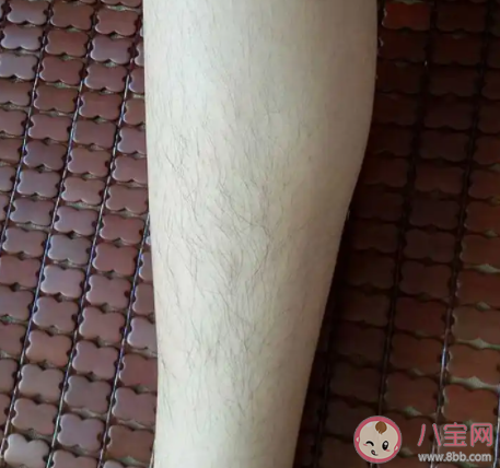 女生為什么會腿毛多 女生腿毛多有福氣嗎