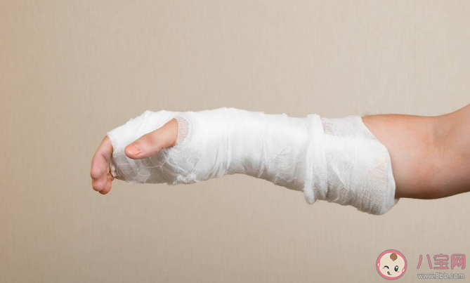 做完骨折手術(shù)后要一直靜養(yǎng)嗎 骨折手術(shù)后要注意什么