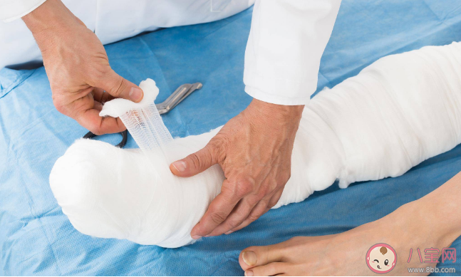 做完骨折手術(shù)后要一直靜養(yǎng)嗎 骨折手術(shù)后要注意什么