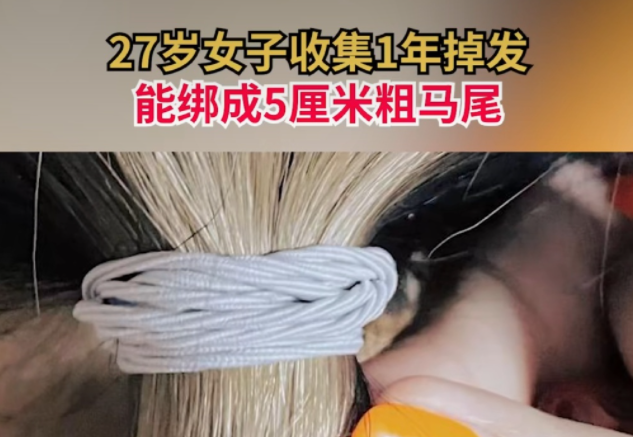 女生收集1年掉發(fā)綁成5厘米粗馬尾 女性脫發(fā)該怎么緩解