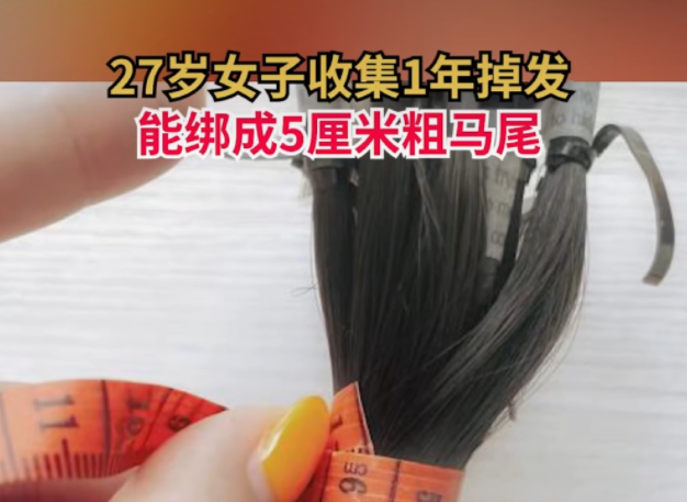 女生收集1年掉發(fā)綁成5厘米粗馬尾 女性脫發(fā)該怎么緩解