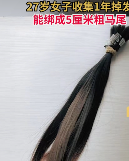 女生收集1年掉發(fā)綁成5厘米粗馬尾 女性脫發(fā)該怎么緩解