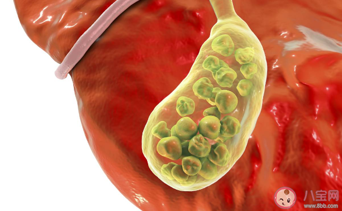 膽囊不好的人有哪些表現 膽囊不好怎么調理