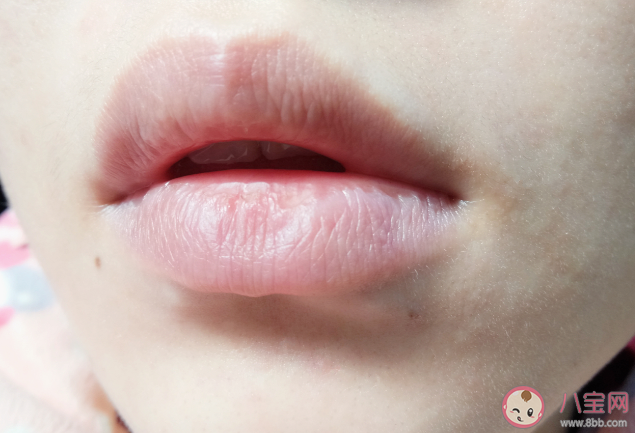 天氣越冷唇紋會越明顯唇色會變深嗎 唇紋又多又深怎么辦