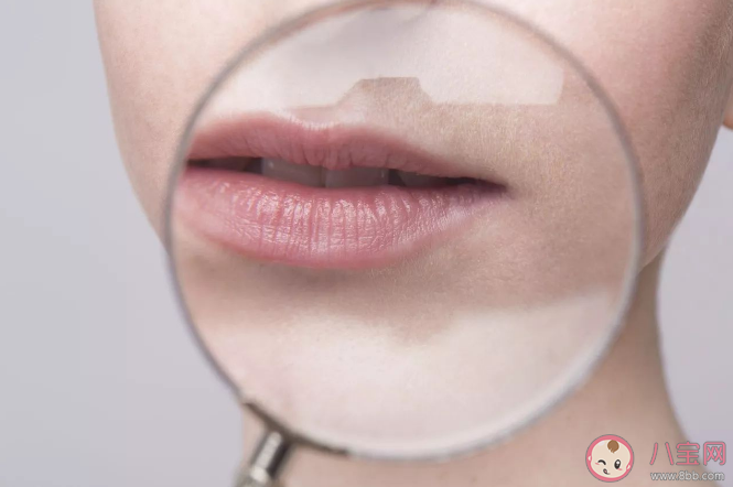 天氣越冷唇紋會越明顯唇色會變深嗎 唇紋又多又深怎么辦