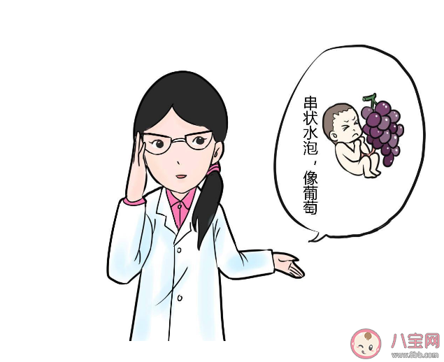 懷孕確診葡萄胎要手術嗎 葡萄胎有哪些預防措施