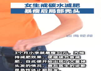 女生戒碳水減肥暴瘦后局部禿頭 合理的減肥是怎樣的