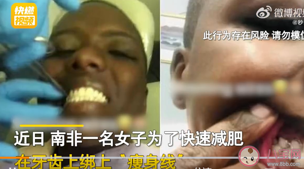 女子為減肥綁牙齒讓嘴巴閉合 怎樣看待極端的減肥方式