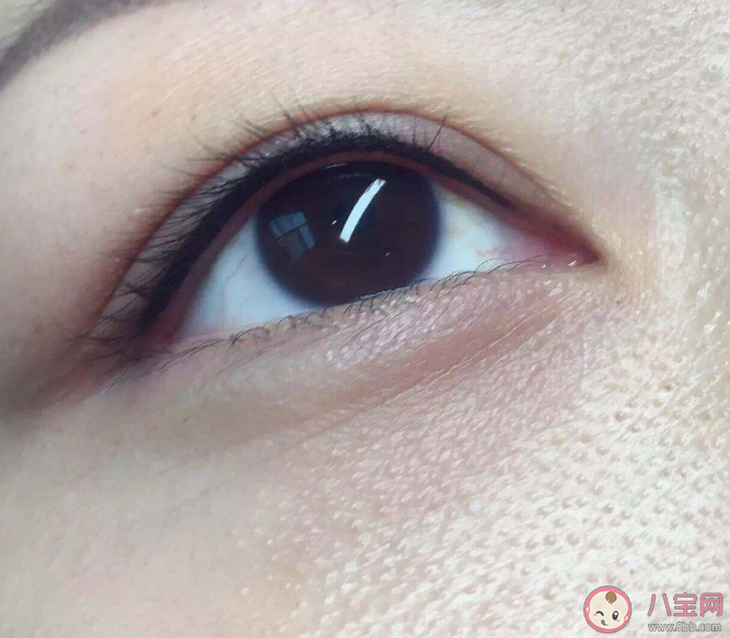 睫毛頻繁脫落可能是感染螨蟲 如何判斷螨蟲感染