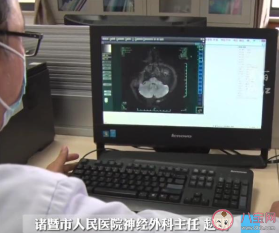 女子飯店吃飯被陌生醫(yī)生提醒患病是怎么回事 垂體瘤的病因是什么