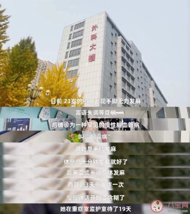 95后女孩產(chǎn)后偏癱竟是煙霧病 什么是煙霧病