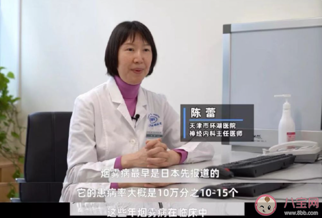 95后女孩產(chǎn)后偏癱竟是煙霧病 什么是煙霧病