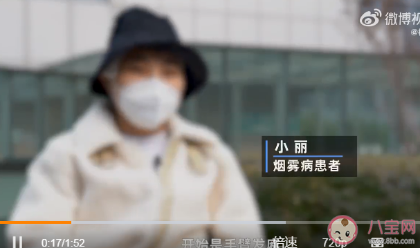 95后女孩產(chǎn)后偏癱竟是煙霧病 什么是煙霧病