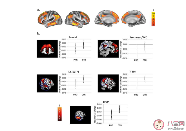 研究稱妊娠或改變女性大腦結構和功能 妊娠對女性的影響有哪些 研究稱妊娠或改變女性大腦結構和功能 妊娠對女性的影響有哪些