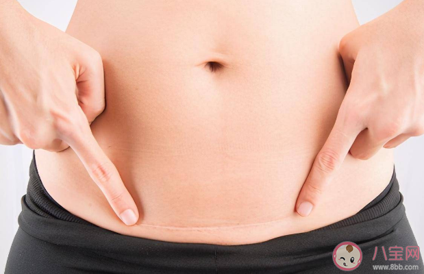 福建一女子為丈夫3年連剖3胎 三年連剖三胎對身體有影響嗎