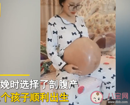 女子二胎懷3胞胎出行要靠輪椅 懷3胞胎有多辛苦