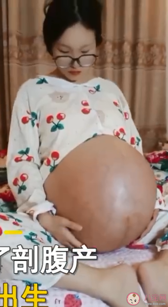 女子二胎懷3胞胎出行要靠輪椅是什么情況 懷了多胞胎需要注意什么