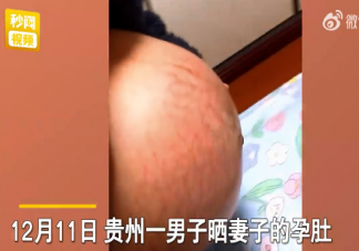 男子稱妻子孕肚像被蜈蚣爬滿太恐怖 妊娠紋該如何消除