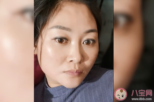 女子感染新冠高燒后滿臉發黑是怎么回事 一般感染新冠會有哪些癥狀