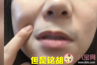 女子回應感染后長出濃密胡子是怎么回事 為什么女生也會長胡子