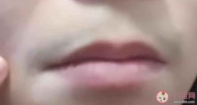 女生回應感染新冠后長出胡子是怎么了 女性長胡子是什么原因