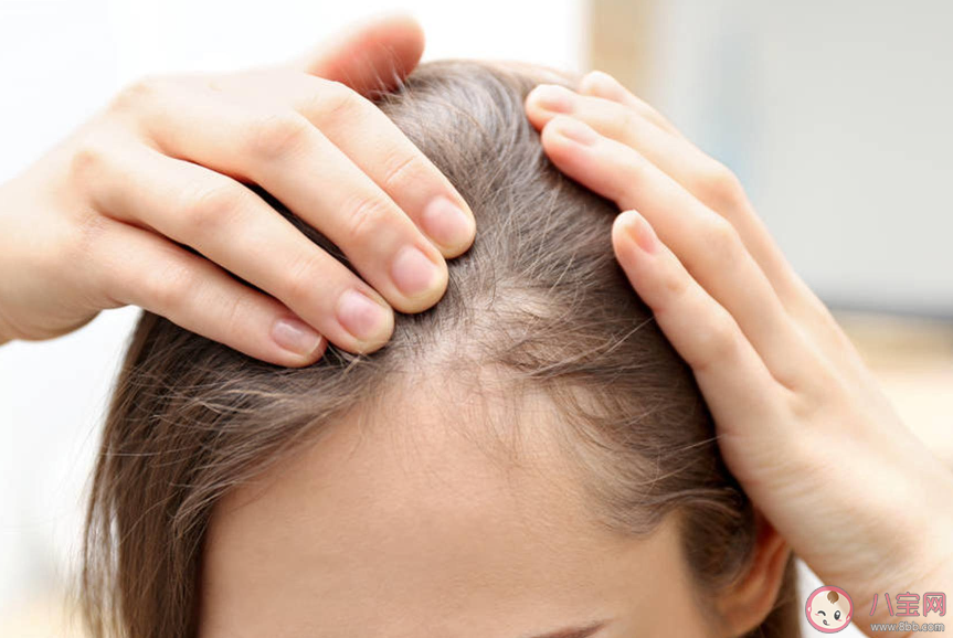 感染新冠后會出現脫發嗎 新冠引起的脫發后面可以長出來嗎