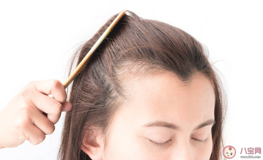 感染新冠后會出現脫發嗎 新冠引起的脫發后面可以長出來嗎