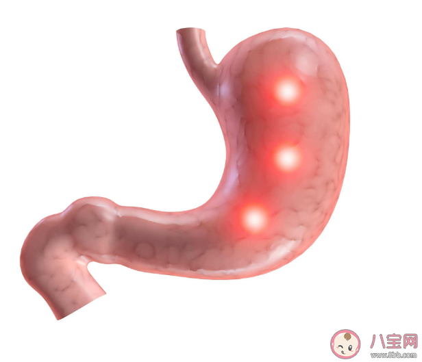 怎么判斷有沒有胃食管反流 胃食管反流哪些是危險人群 怎么判斷有沒有胃食管反流 胃食管反流哪些是危險人群