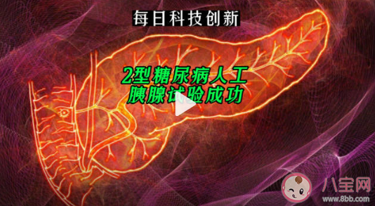 2型糖尿病人工胰腺試驗(yàn)成功是真的嗎 人工胰腺有什么作用 2型糖尿病人工胰腺試驗(yàn)成功是真的嗎 人工胰腺有什么作用